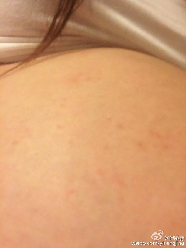 伊能靜臨產腳腫肚子過敏