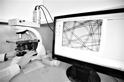 顯微鏡下，聚酯纖維很光亮，表面有斑點(diǎn)，粗細(xì)非常均勻。