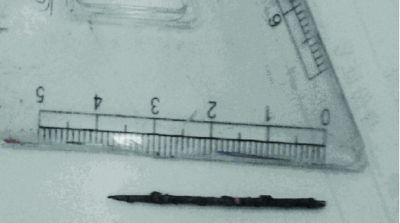 取出的繡花針已發(fā)黑生銹。