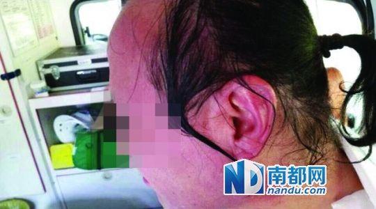 涉事教師遭熱水潑臉后的照片。