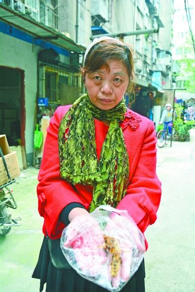 頭部受傷的黃女士展示兩根大魚刺。