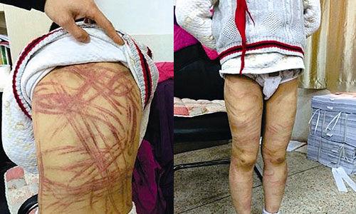 南京虐童案養(yǎng)母致歉：將用加倍關愛彌補過失