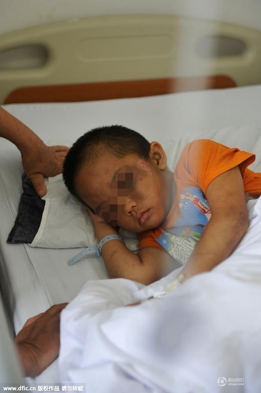 圖為全身傷痕累累的小進。