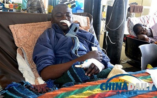 雖然已經(jīng)在醫(yī)院接受了近一個月的恢復(fù)治療，卡托卡的身體仍然非常虛弱。