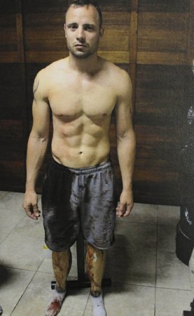 “刀鋒戰(zhàn)士”皮斯托瑞斯過失槍殺女友現(xiàn)場(chǎng)照片。