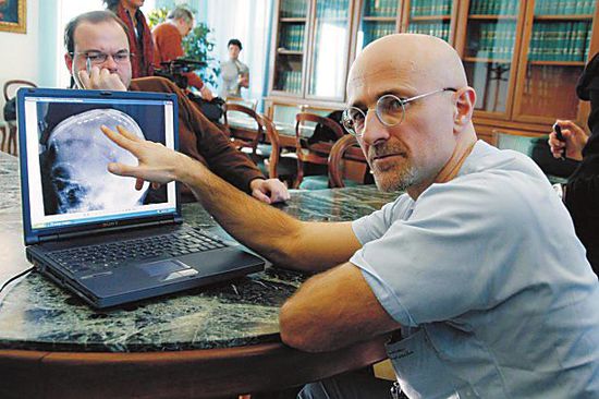 圖為卡納維洛醫(yī)生，不少人認(rèn)為他的想法非常瘋狂