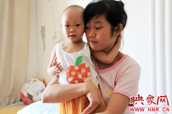 孩子和媽媽在一起，她的右眼已經(jīng)失明。