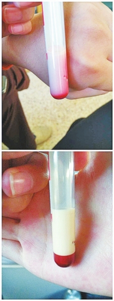 信陽(yáng)嬰兒患怪病血液呈乳白色 求助權(quán)威機(jī)構(gòu)查病因遭拒