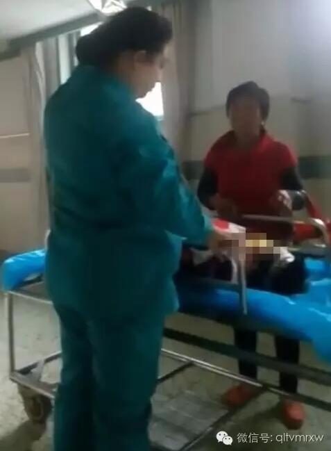 涵涵爸爸告訴《每日新聞》記者：“沒想到是熱水，大人也沒看，一時(shí)疏忽，掉進(jìn)去了。抱出來的時(shí)候這個皮已經(jīng)掉了。”