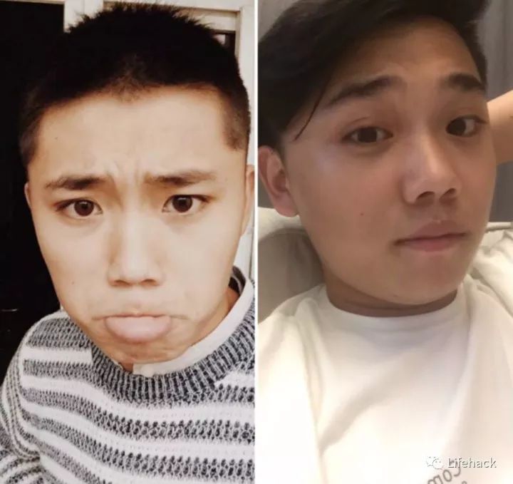 長胖20斤，臉型怎么變？這些例子看完扎心了！