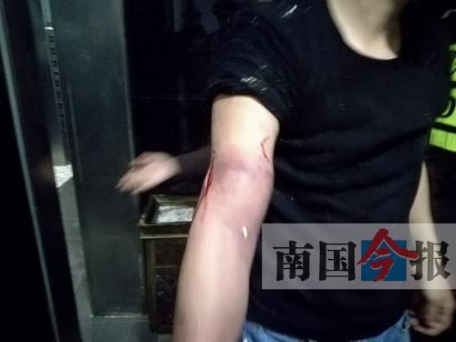 覃先生手臂被卡的部位受傷流血，所幸傷勢無大礙。 通訊員 王建民 攝