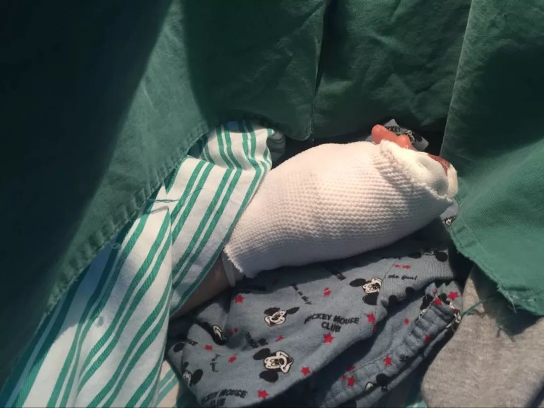 嚇哭！6歲男孩被夾斷手指 罪魁禍首竟是校服