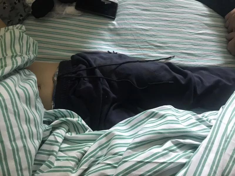 嚇哭！6歲男孩被夾斷手指 罪魁禍首竟是校服