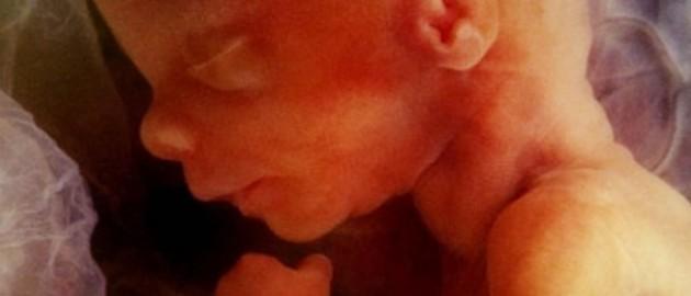 科學(xué)家研發(fā)可在子宮內(nèi)為胎兒做手術(shù)機器人