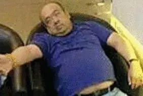 網(wǎng)傳金正男中毒后的照片。