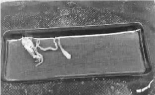 小孩腦部發(fā)現(xiàn)的白色條狀蟲體 小孩腦部發(fā)現(xiàn)的白色條狀蟲體