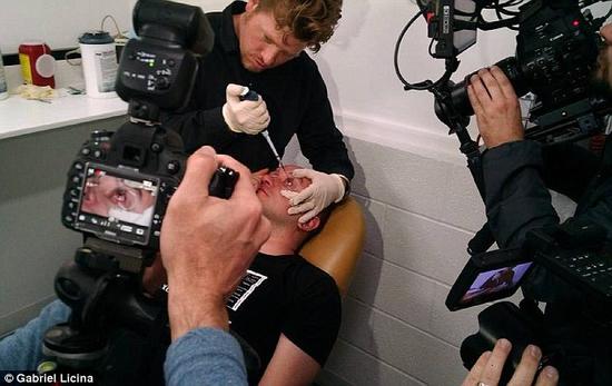 該實(shí)驗(yàn)是由加州一支名為“生物駭客”的實(shí)驗(yàn)團(tuán)隊(duì)開(kāi)展的。他們使用了一種名為二氫卟吩e6（Ce6）的物質(zhì)的溶液。Ce6常見(jiàn)于深海魚(yú)體內(nèi)，有光敏特性，通常用于癌癥治療研究中。研究團(tuán)隊(duì)將Ce6與胰島素和鹽水混合起來(lái)，得到一種溶液，可以在低光照條件下提高人類(lèi)的視力。