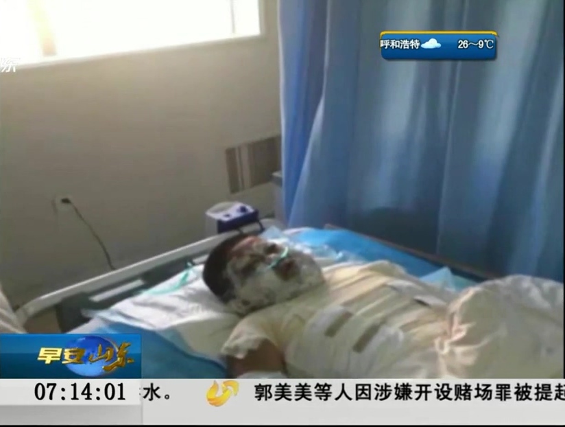 9歲男孩被汽油燒身 兇手竟是前舅媽