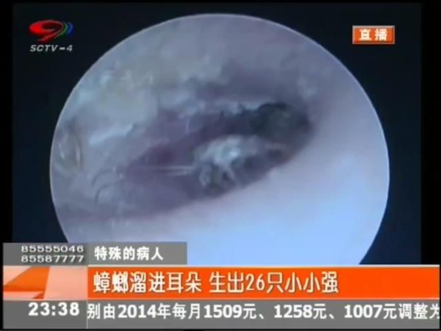 小強溜進耳朵？生26只小小強