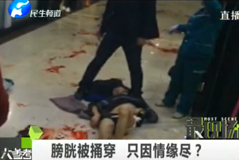 膀胱被捅穿 只因情緣盡？